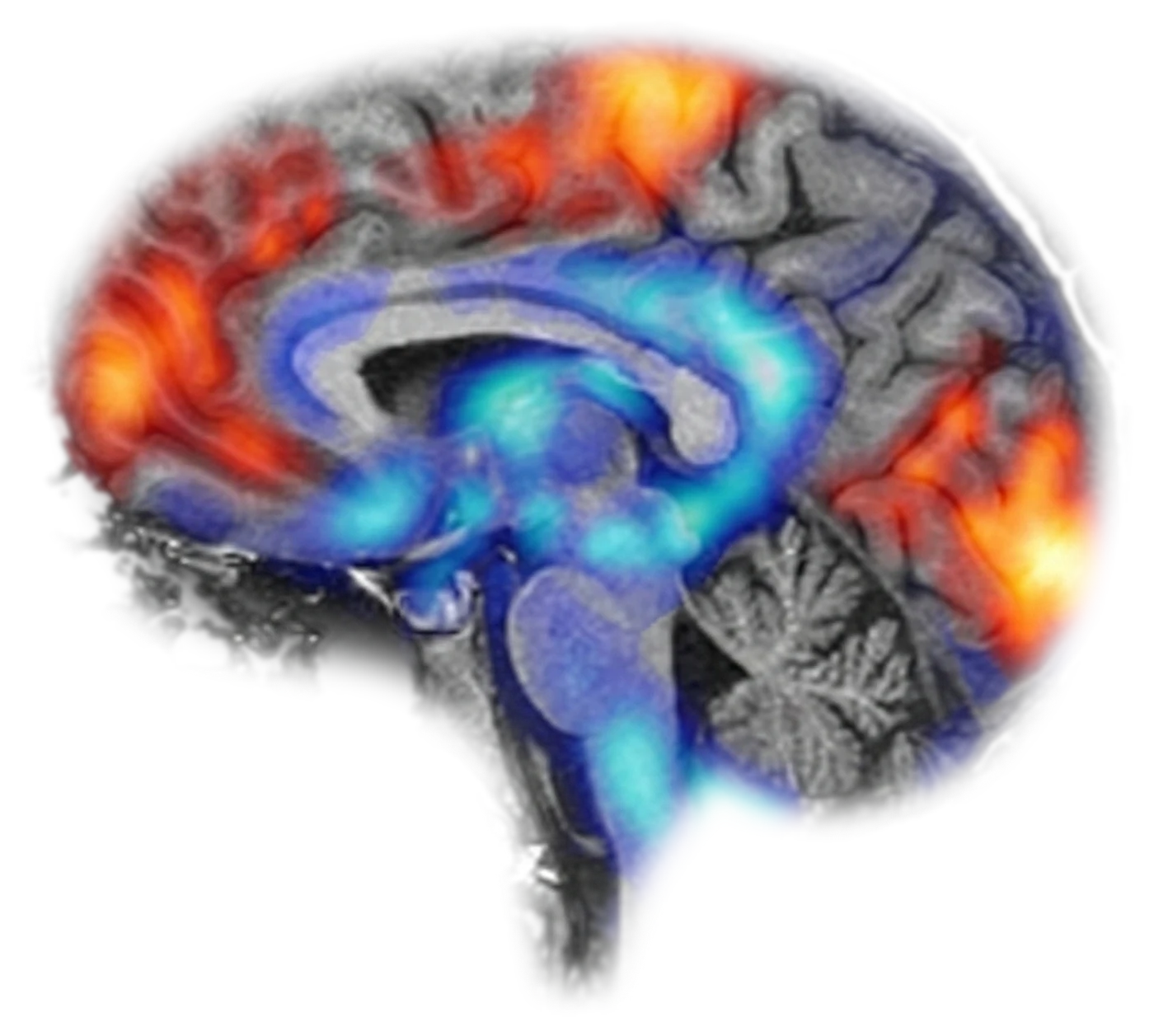 Atlas neural de AtlasHumano